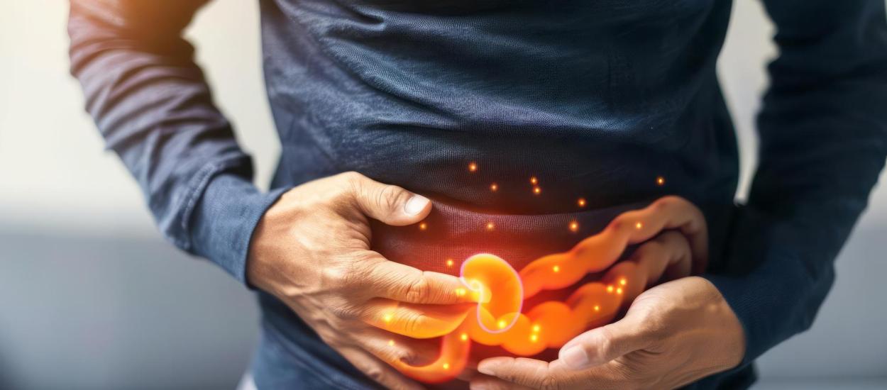 Afecțiunea digestivă comună care crește riscul de cancer de colon cu 600%