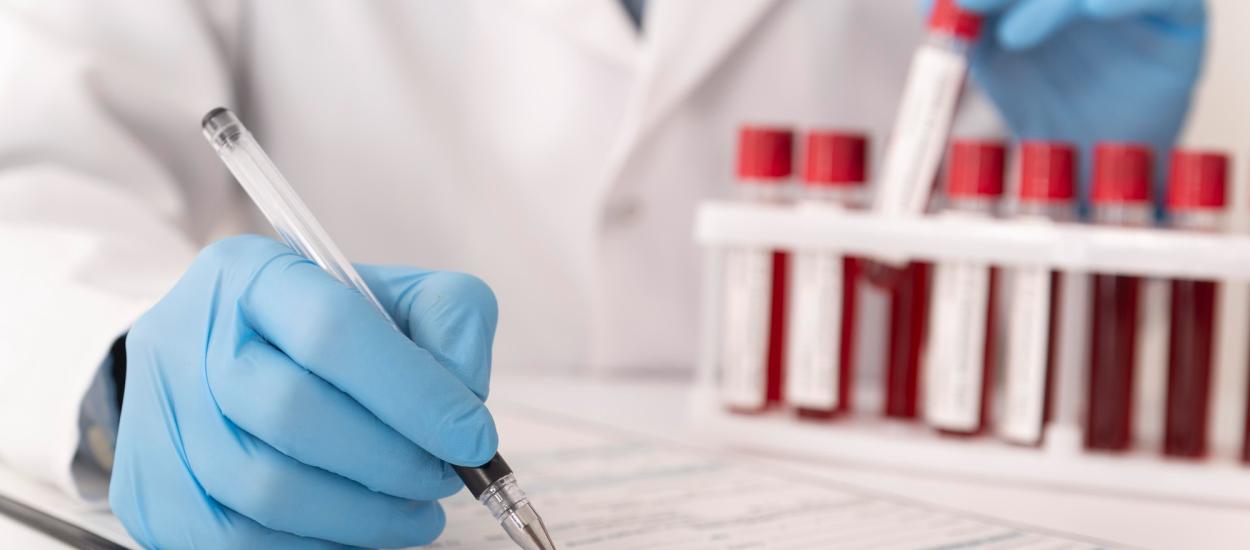 CRP și VSH: când arată inflamație și când pot fi alarme false