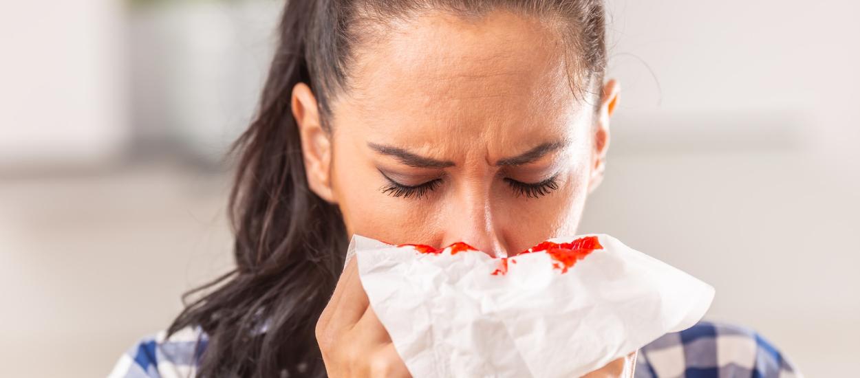 De ce îți curge sânge din nas? Epistaxis (sângerare nazală): de ce apare și când devine urgență