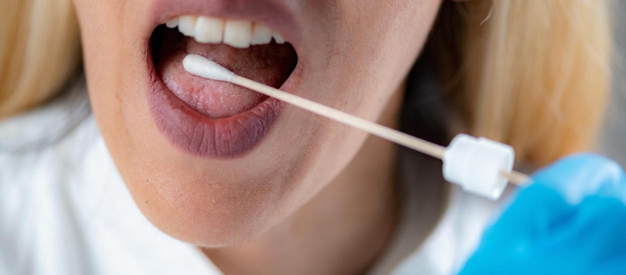 Testul rapid de salivă care poate detecta cancerul