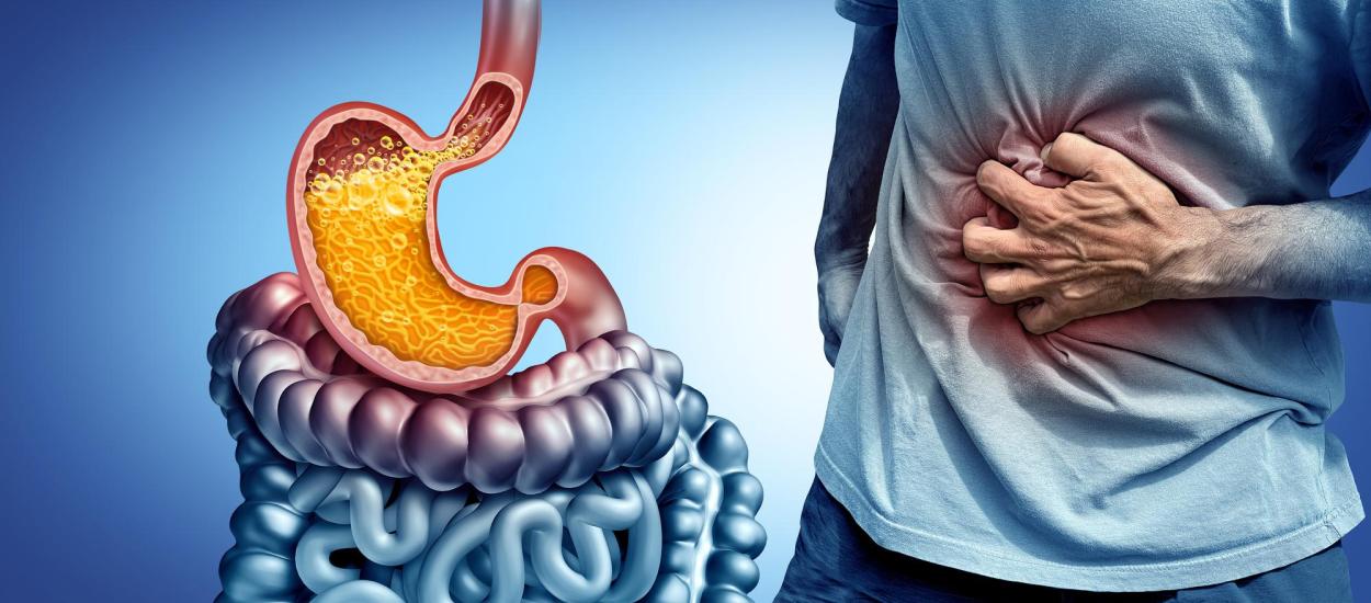 ARMA, tehnica ce elimină refluxul gastroesofagian. Prof. dr. Gabriel Constantinescu (SANADOR): Pacientul merge acasă