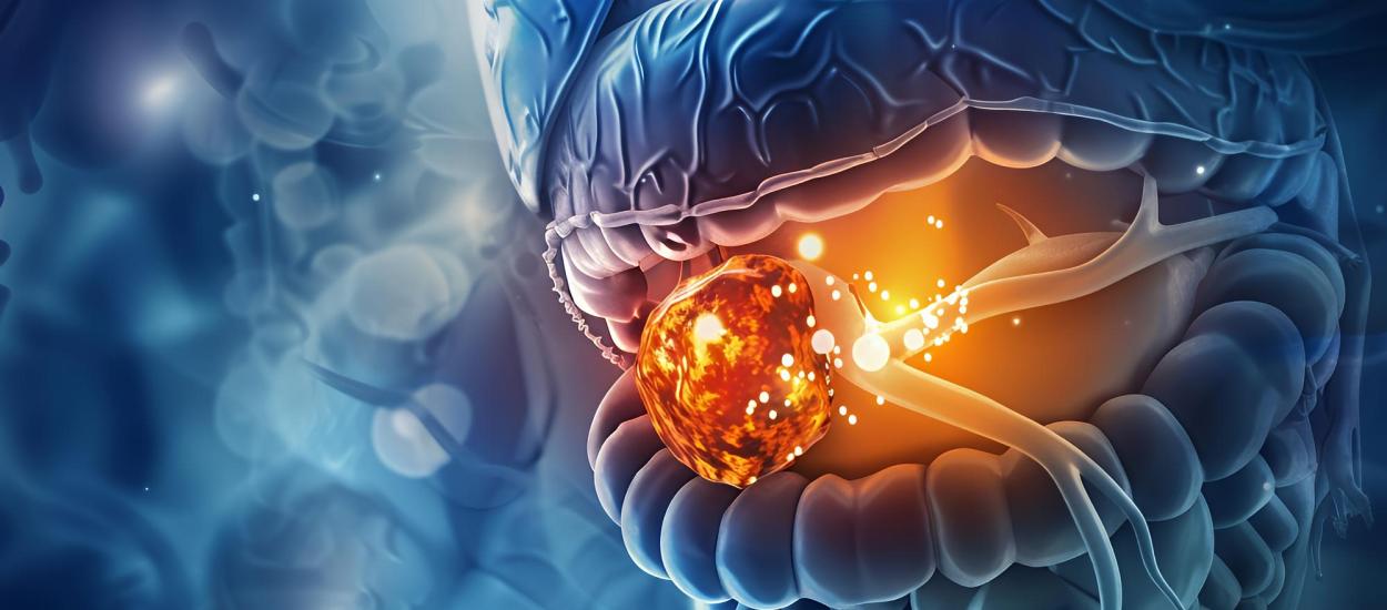 Cum pot fi tratate tumorile fără bisturiu. Prof. dr. Gabriel Constantinescu: Minim invaziv