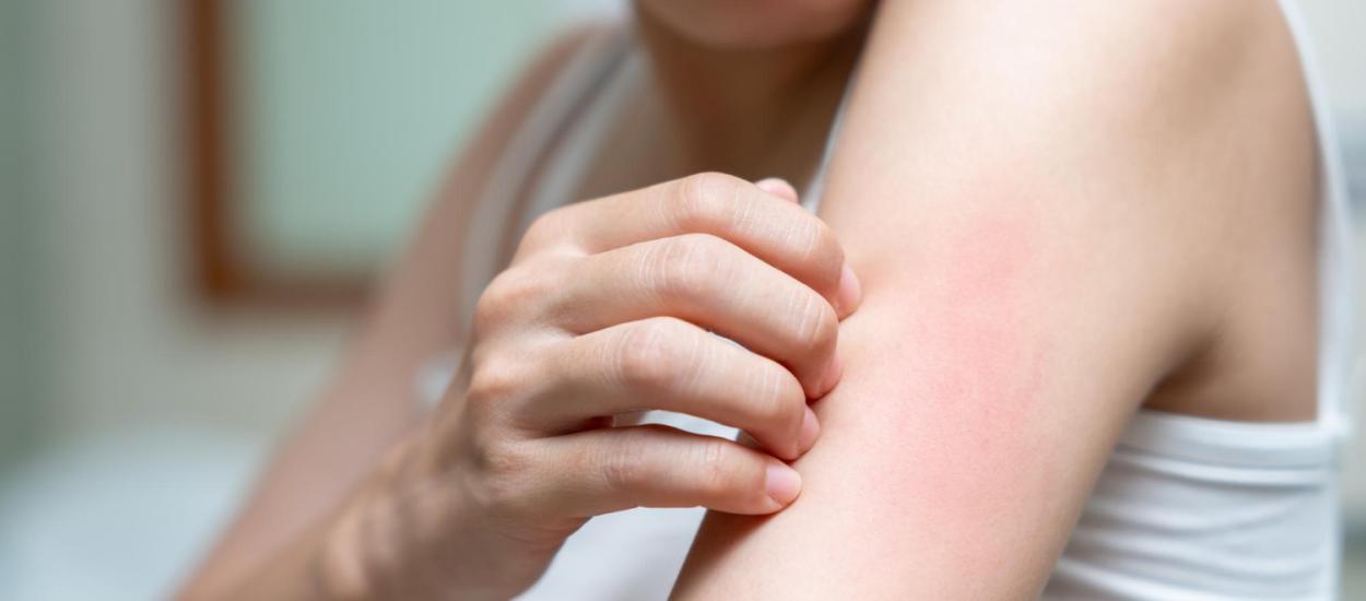 Alcoolul benzilic, desemnat alergenul anului 2026. Unde se găsește și ce efecte are