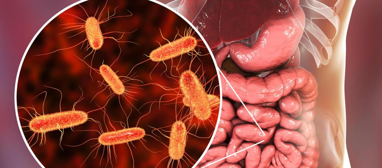 Virusul care crește riscul de cancer colorectal