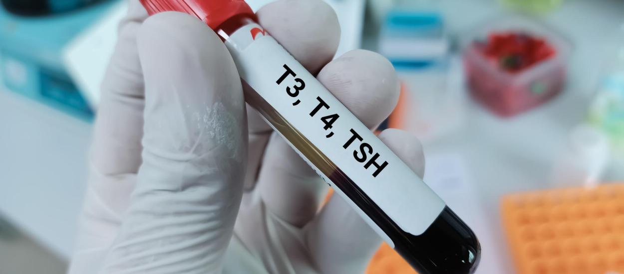 Ce înseamnă valorile TSH, care este intervalul normal și ce simptome apar când nivelul este prea mare sau prea mic