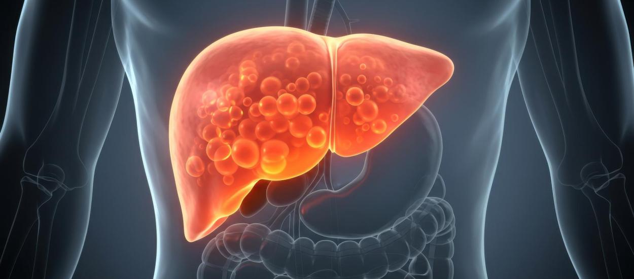Boala de ficat care va afecta 1,8 miliarde de oameni până în 2050