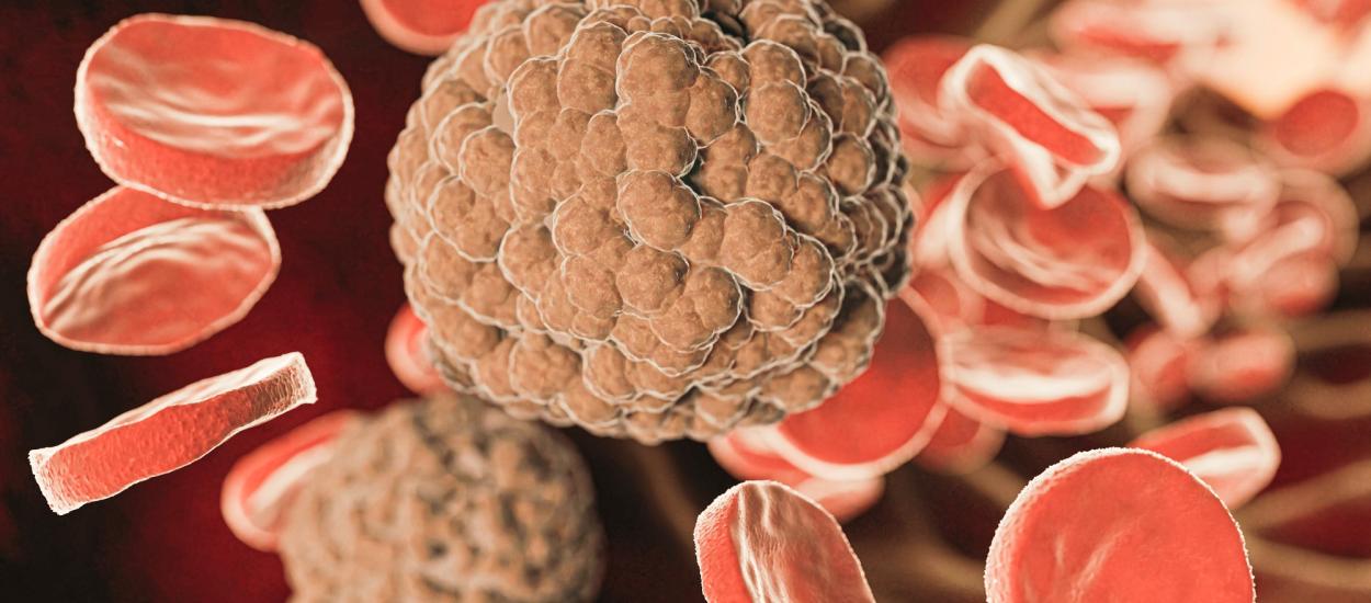 Ce trebuie să știi dacă ai trigliceridele mărite. Dr. Eva Deak: Bombă cu ceas!