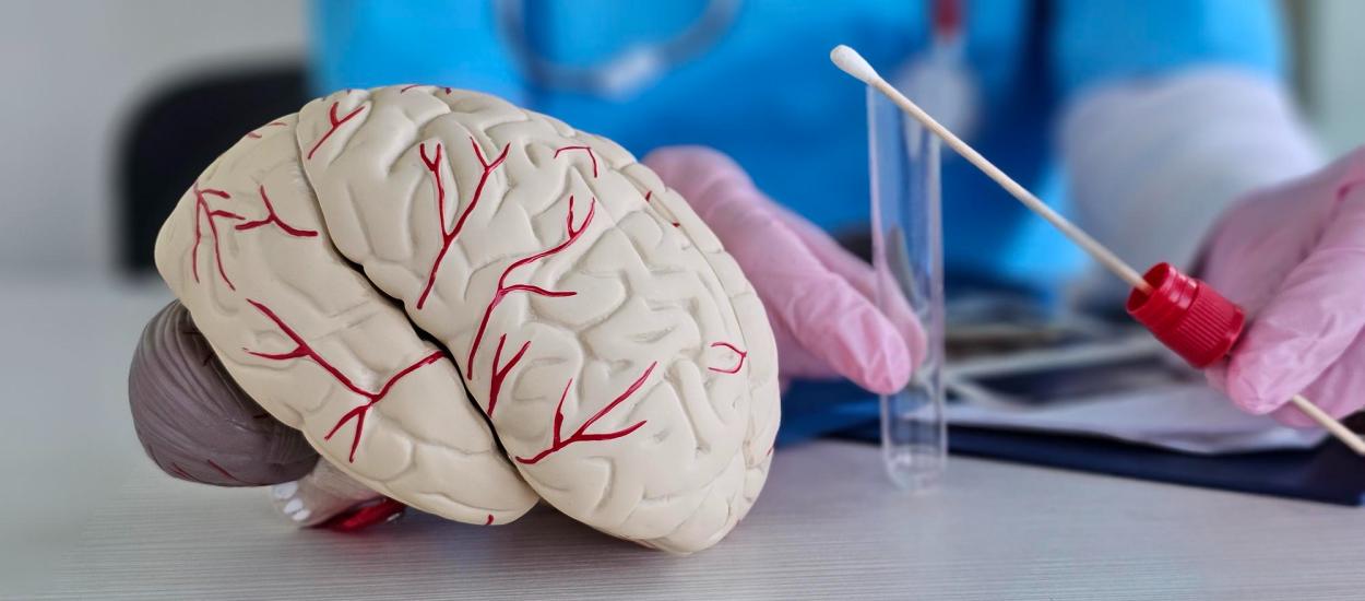 Testul de sânge care prezice Alzheimer cu ani înainte de primele semne