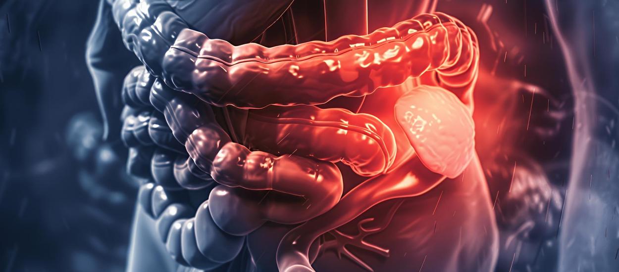 De ce crește alarmant numărul cazurilor de cancer colorectal sub 65 de ani