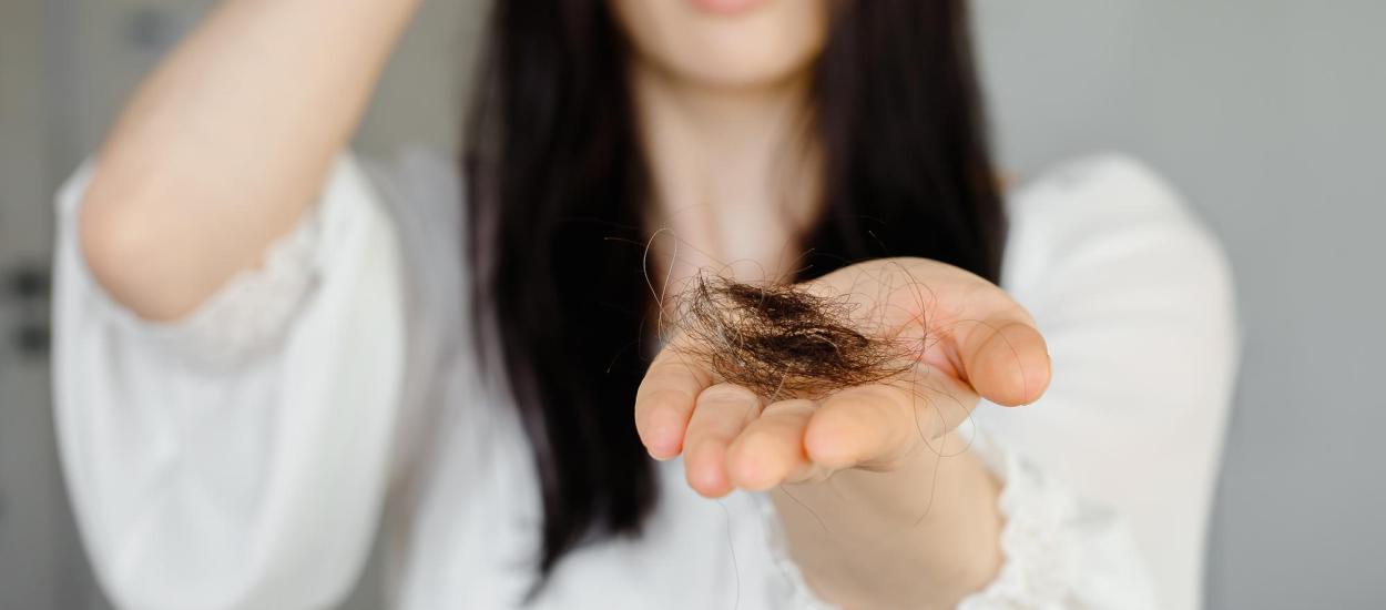 Căderea părului la femei: impactul hormonilor de la pubertate până la menopauză