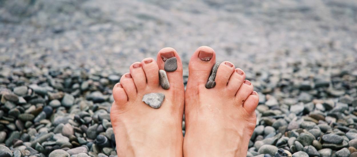 Cum să scapi corect de calusurile de pe picioare. Ce spun medicii