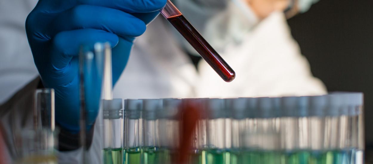 Testul de sânge banal care prezice riscul de Alzheimer cu ani înainte de simptome