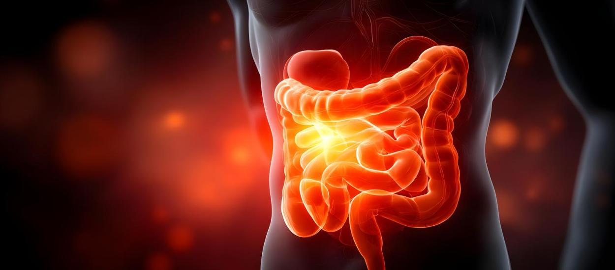 Noi factori de risc pentru cancerul colorectal precoce. Obezitatea și antibioticele cresc incidența 