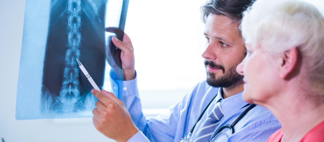 Osteoporoza, tratată mai eficient? Descoperirea care ar putea reduce riscul de fracturi