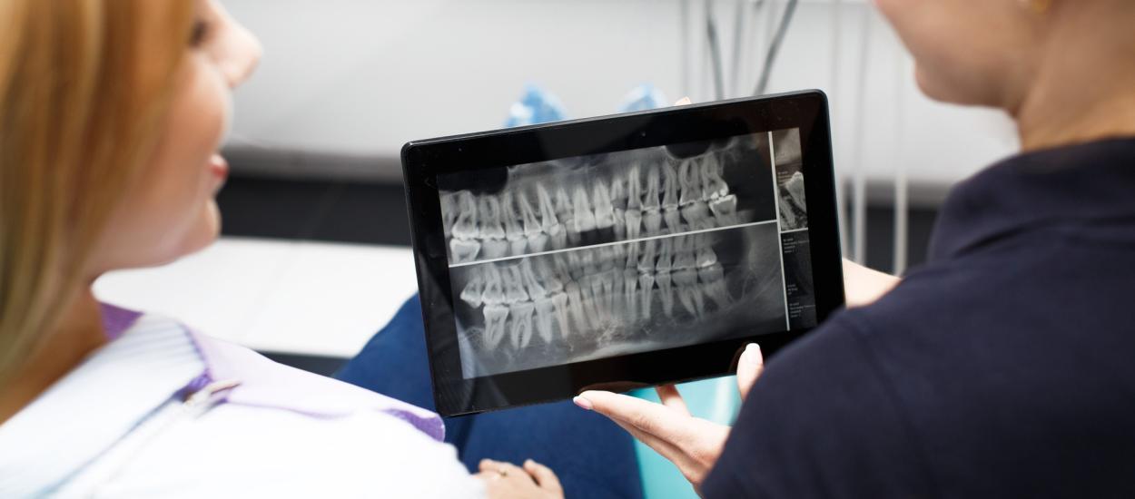 De ce antibioticele nu dau rezultate în cazul infecțiilor asociate implanturilor dentare
