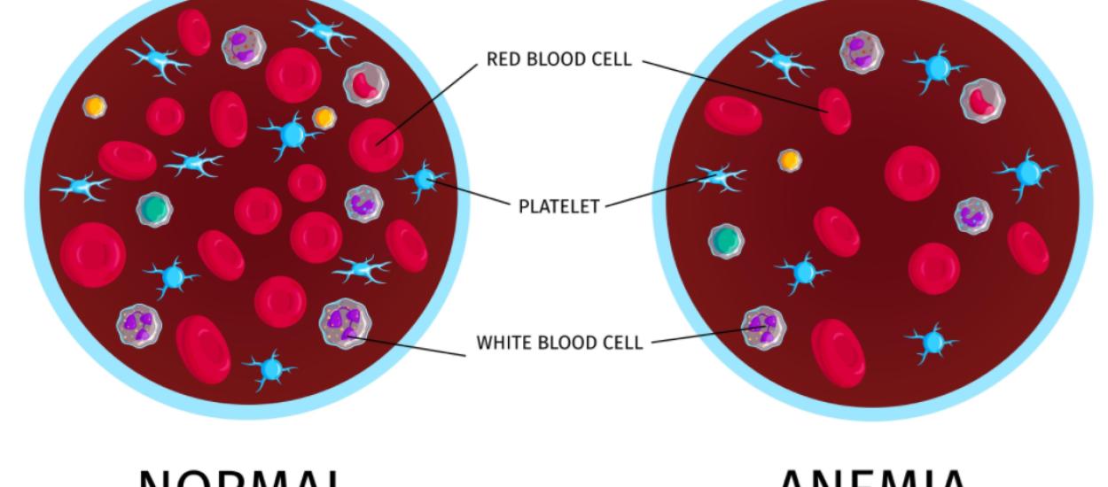 De ce apare anemia? Cercetătorii au identificat un hormon care „frânează” formarea globulelor roșii