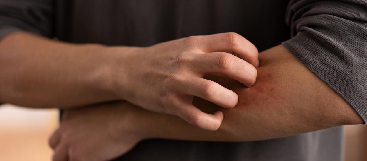 Cum să te protejezi de „atacul invizibil” al insectelor în sezonul cald