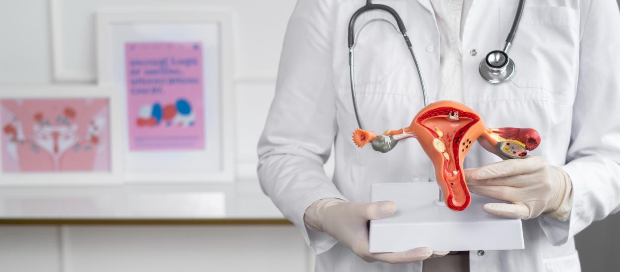 Cum ajunge cancerul ovarian rezistent la chimioterapie și cum se poate contracara acest fenomen