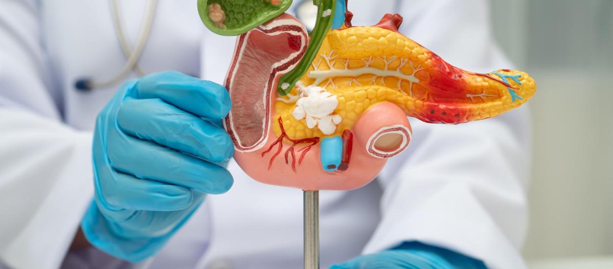 Un nou medicament aproape dublează supraviețuirea pacienților cu cancer pancreatic metastatic