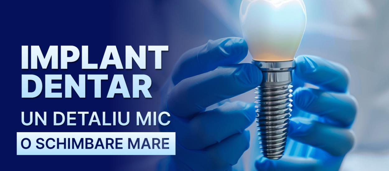 Cât costă cu adevarat un implant dentar în București  