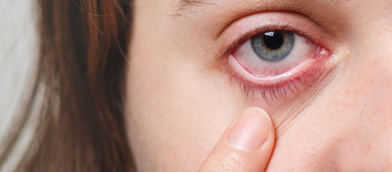 FDA aprobă un tratament nou pentru boala oculară tiroidiană
