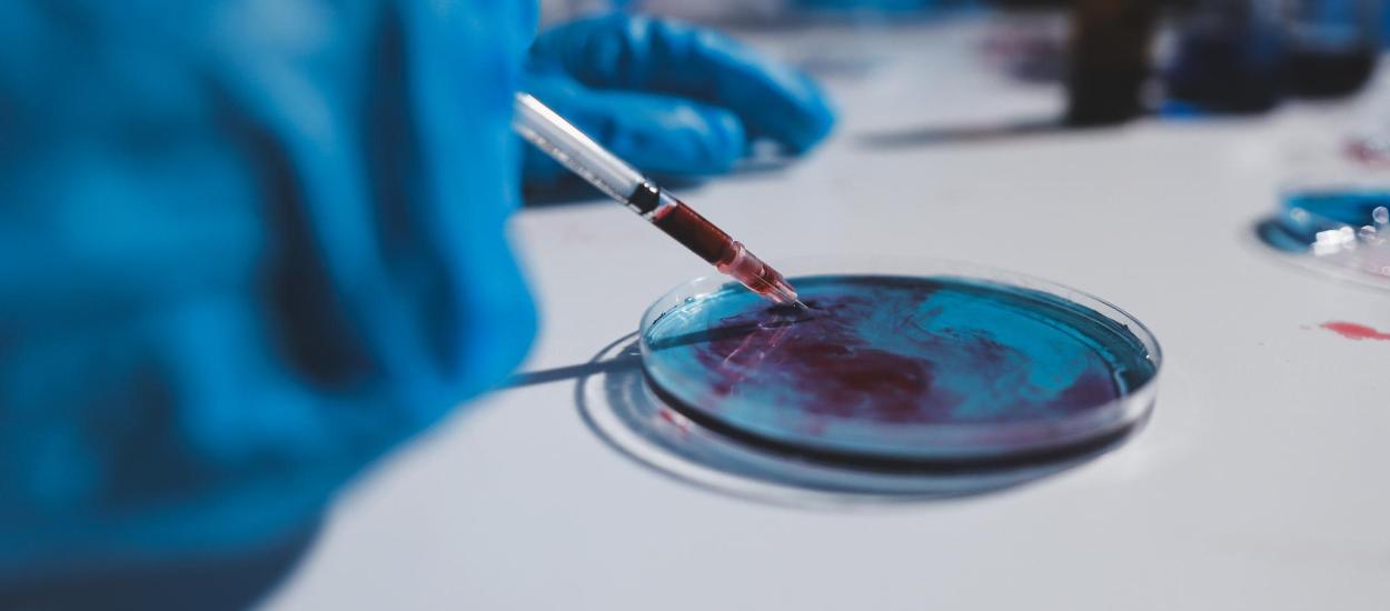 Răspândește biopsia cancerul? Dr. Florentina Bratu (SANADOR): Teamă nejustificată