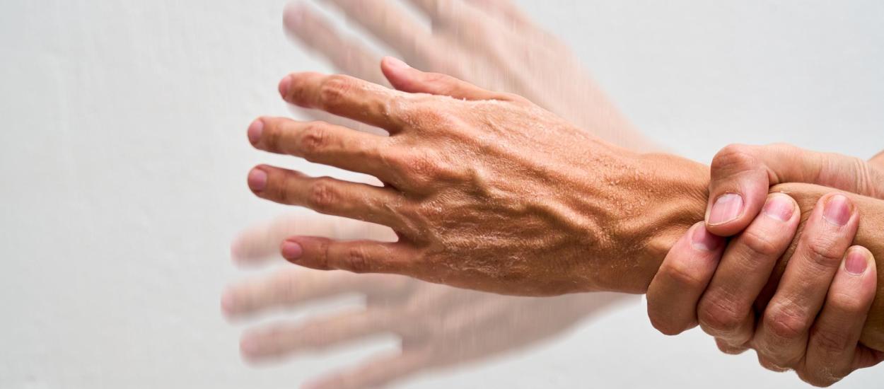 Boala Parkinson, descoperită fără proceduri invazive. Senzorul care schimbă diagnosticul