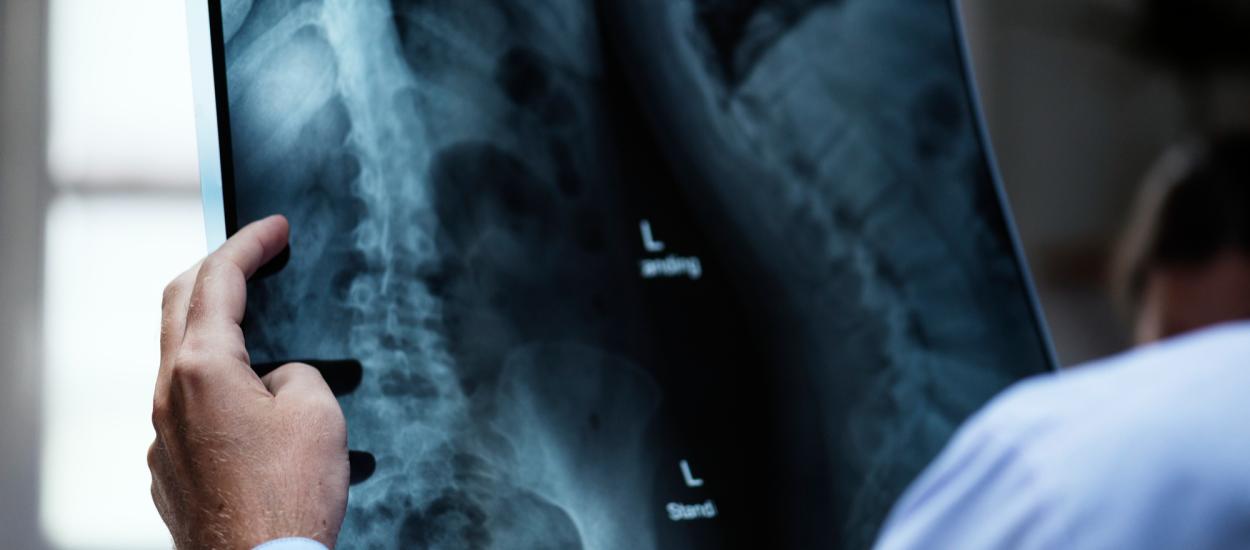 Premieră istorică în medicină: Au fost făcute primele radiografii în spațiu 
