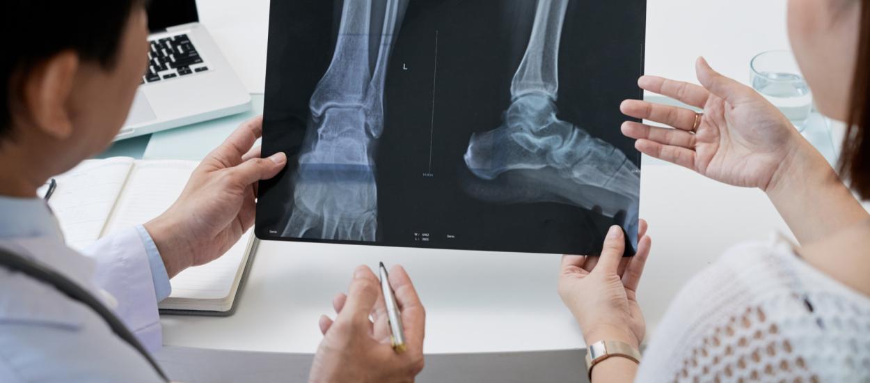 Fracturile pot ascunde o boală gravă a oaselor. Medicii avertizează: nu doar șoldul ar trebui să ridice suspiciuni