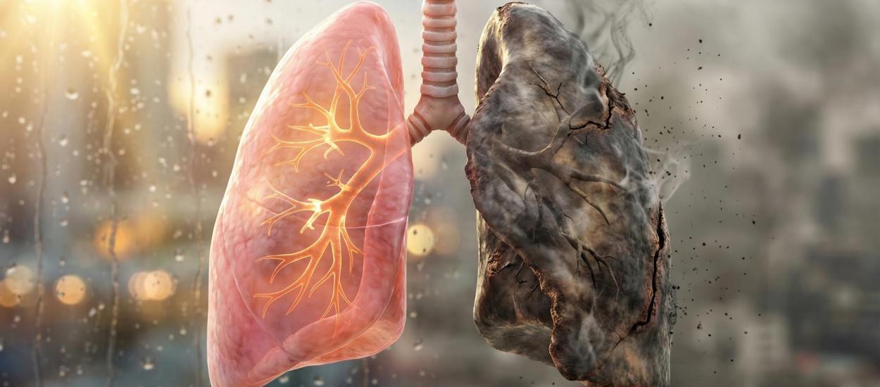 Semnul banal al cancerului pulmonar. Când trebuie să mergi la medic