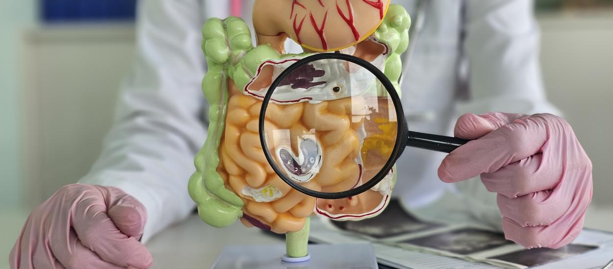 Ce trebuie să mănânci DUPĂ cancerul de colon? Dieta simplă care reduce riscul de deces cu 87%