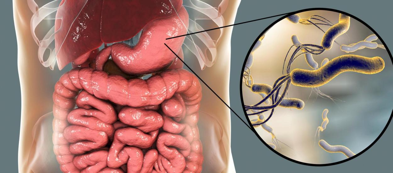 Semnalul din stomac pe care mulți îl ignoră. Ce înseamnă cu adevărat un test pozitiv pentru Helicobacter pylori și greșeala care poate face tratamentul mult mai dificil