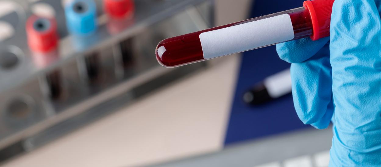 Testul de sânge care poate indica un risc mai mare de cancer, cu ani înainte de diagnostic