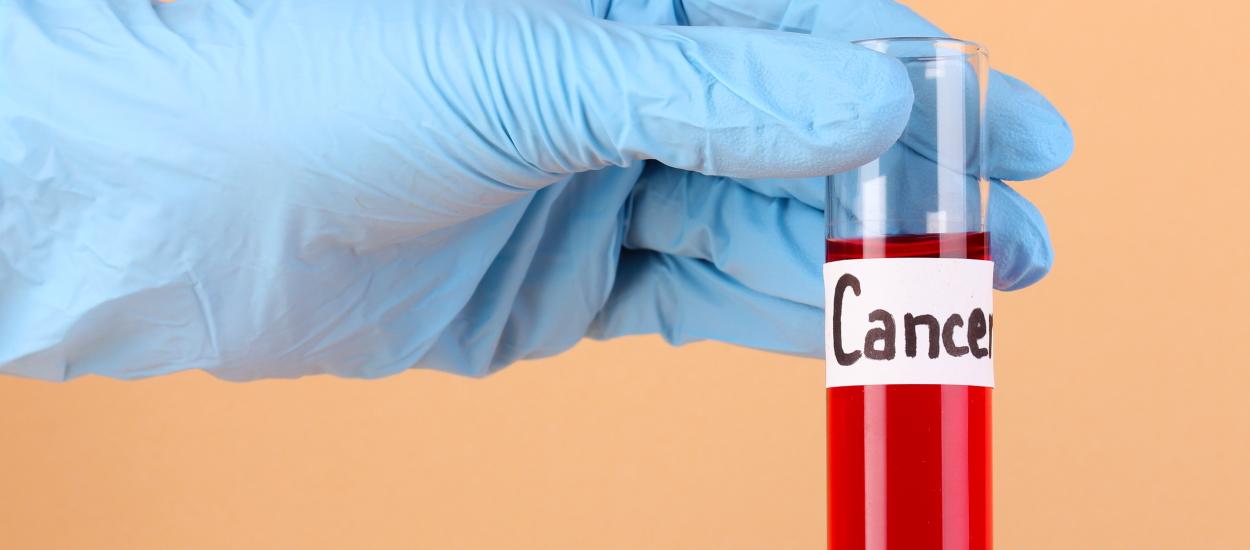 Testul de sânge care poate depista din timp recidiva cancerului