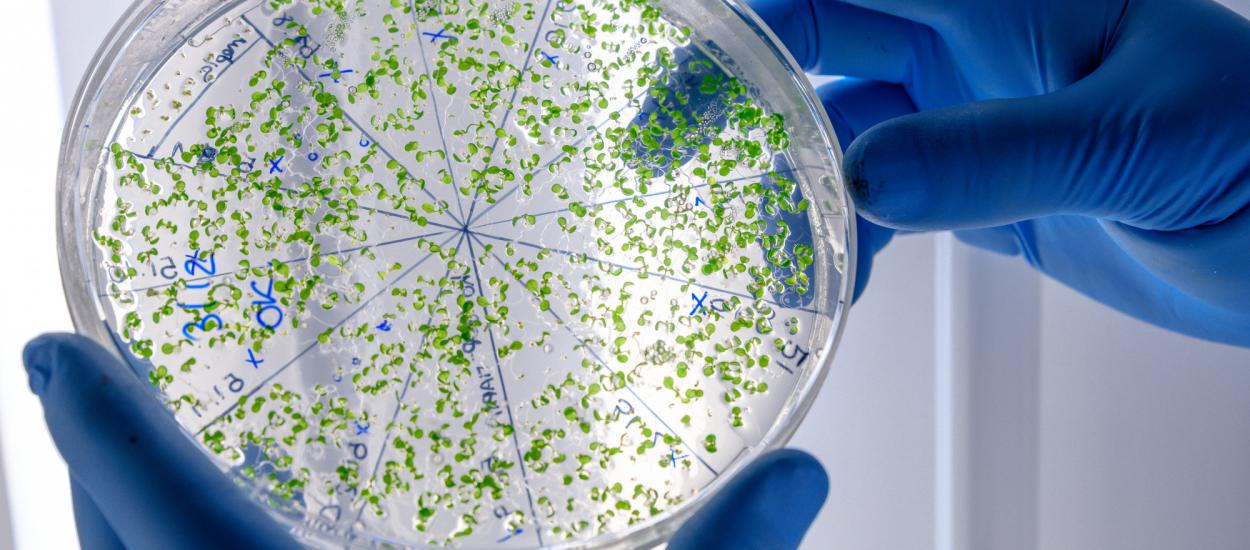 Salmonella nu îi îmbolnăvește pe toți la fel. Când rămâne în intestin și când ajunge în sânge?