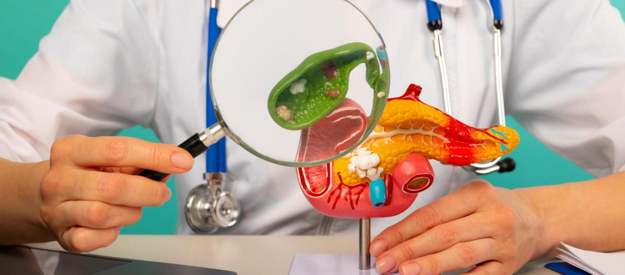 Care este legătura dintre cancerul pancreatic și colesterol
