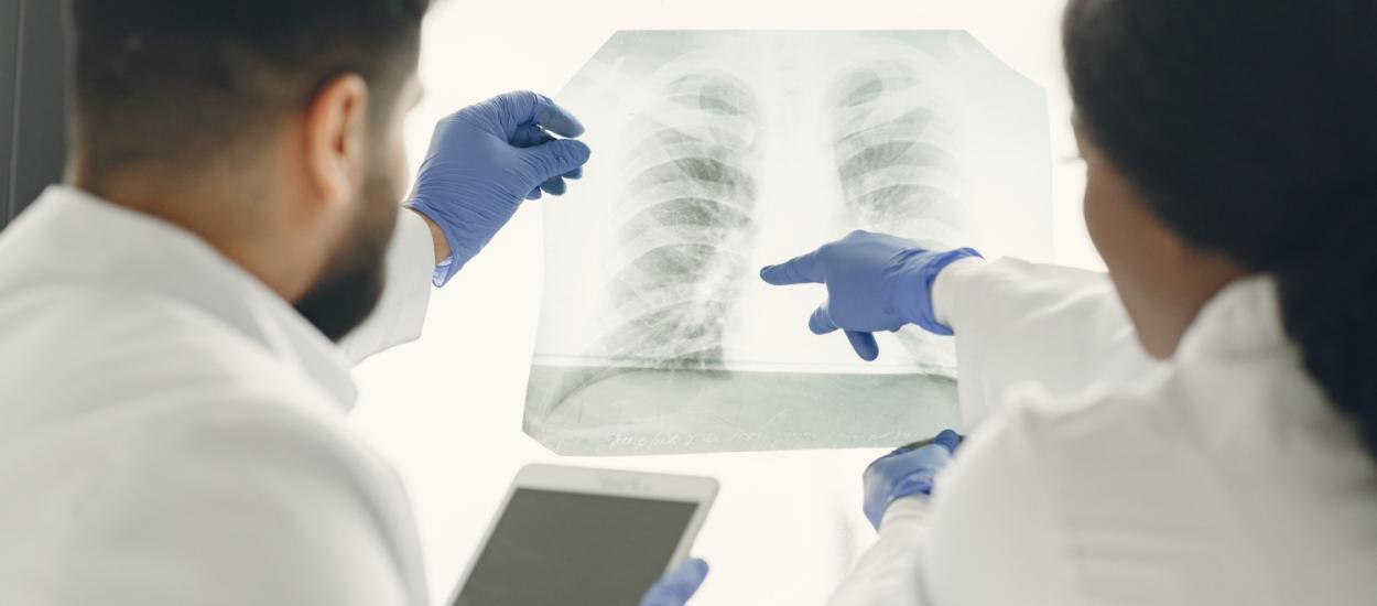 Cancer pulmonar fără să fi fumat vreodată. De ce sunt din ce în ce mai multe cazuri?