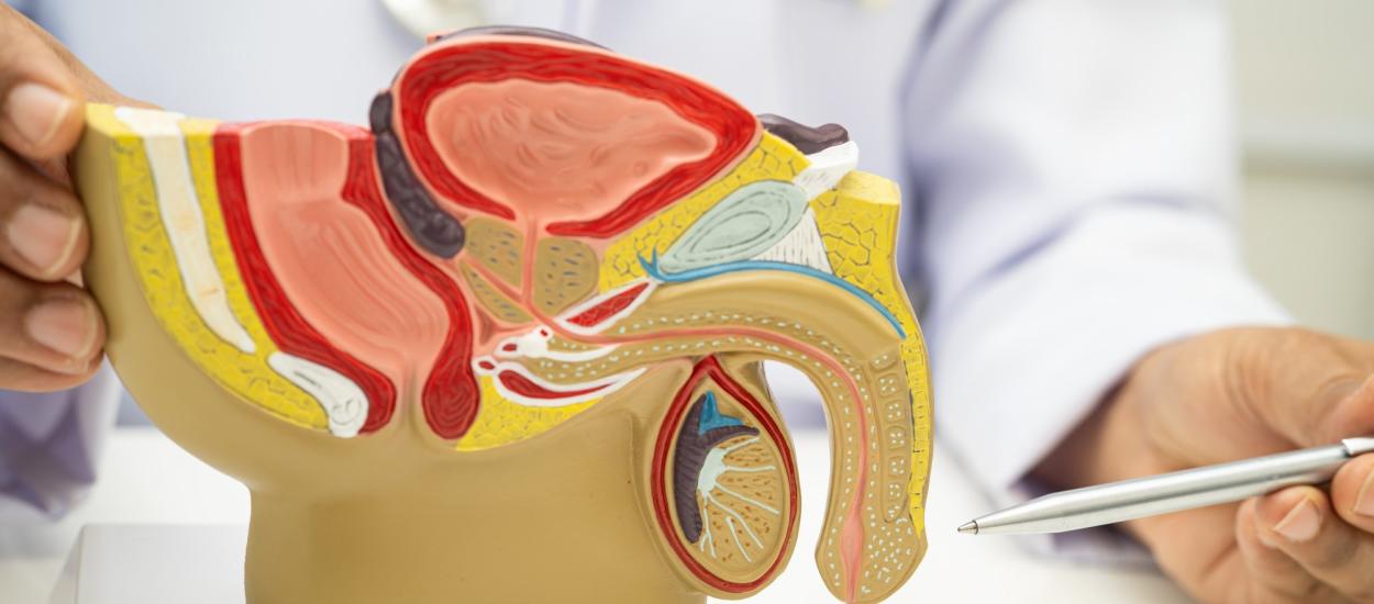 Ce legătură există între cancerul de prostată și colesterol
