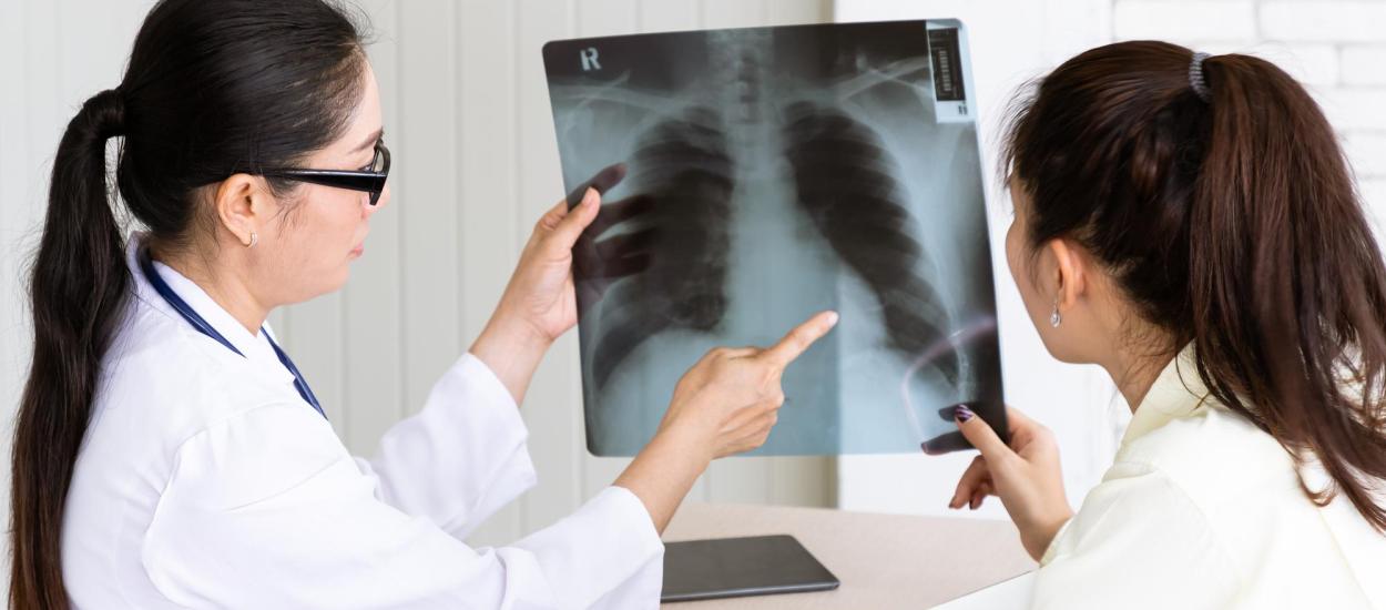 Respirăm plastic? Microplasticele găsite în plămânii pacienților cu cancer pulmonar ridică semne de întrebare