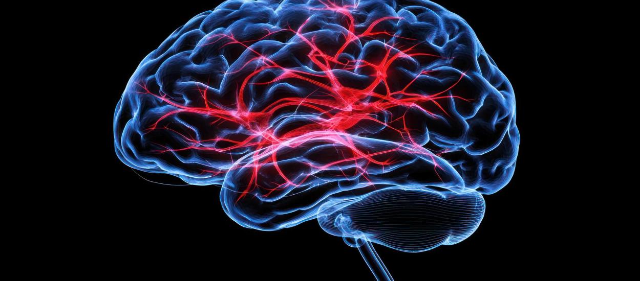 Ce se întâmplă cu pacientul după un AVC sever. Dr. Andra Enache explică ce este neuropaliația