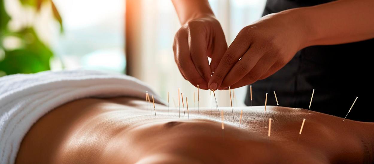 Acupunctura chiar funcționează? Simptomele pe care le poate ameliora și limitele tratamentului