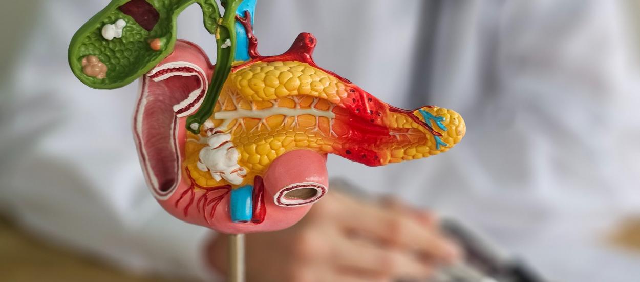 Cum păcălește cancerul pancreatic sistemul imunitar. Doar 5% dintre celule pot proteja tumora