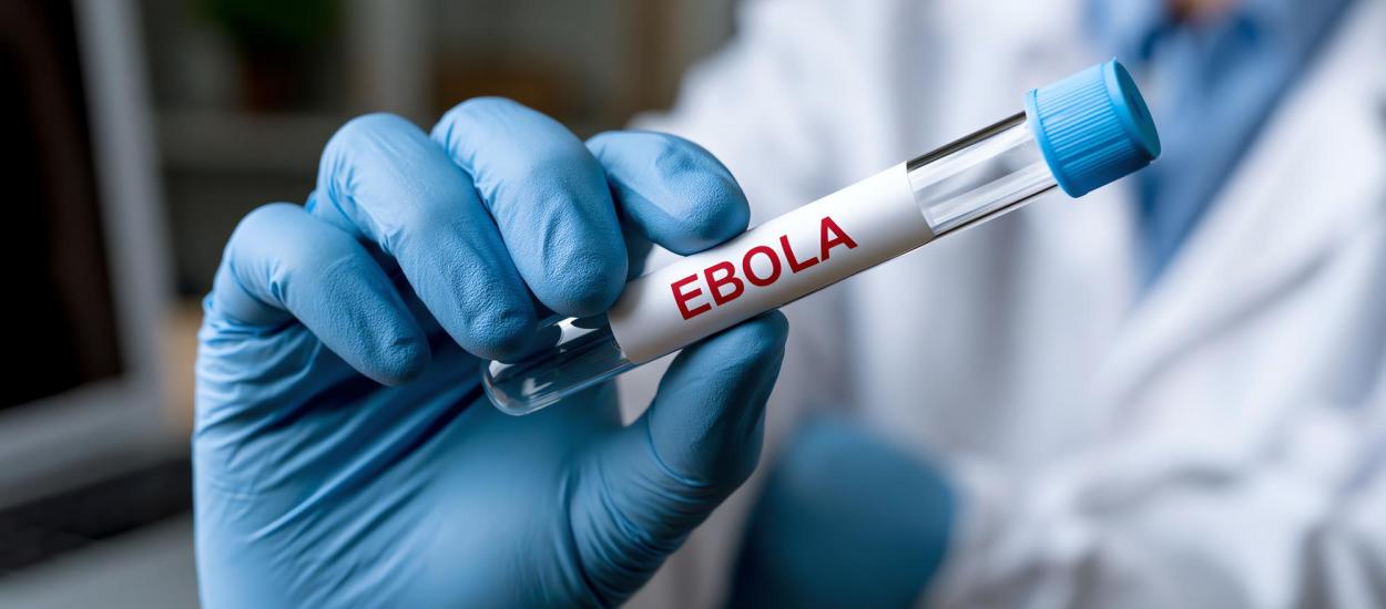 Virusul Ebola se extinde. Dr. Manuel Albela Miranda explică de ce este atât de greu de ținut sub control