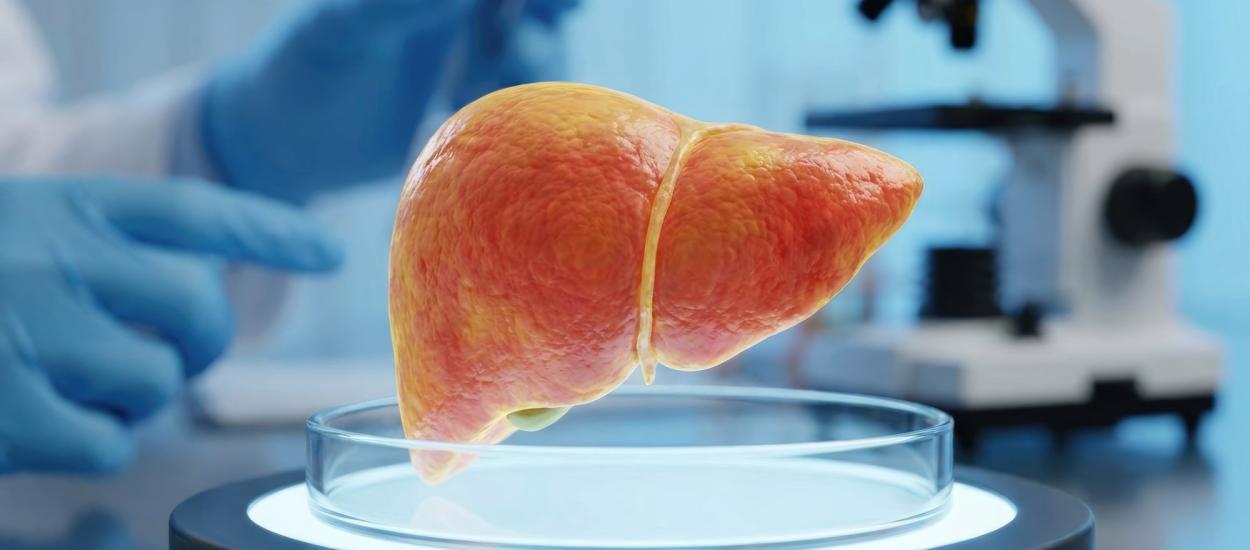 Ficatul gras poate evolua ani la rând fără simptome. Care sunt semnele care pot atrage atenția